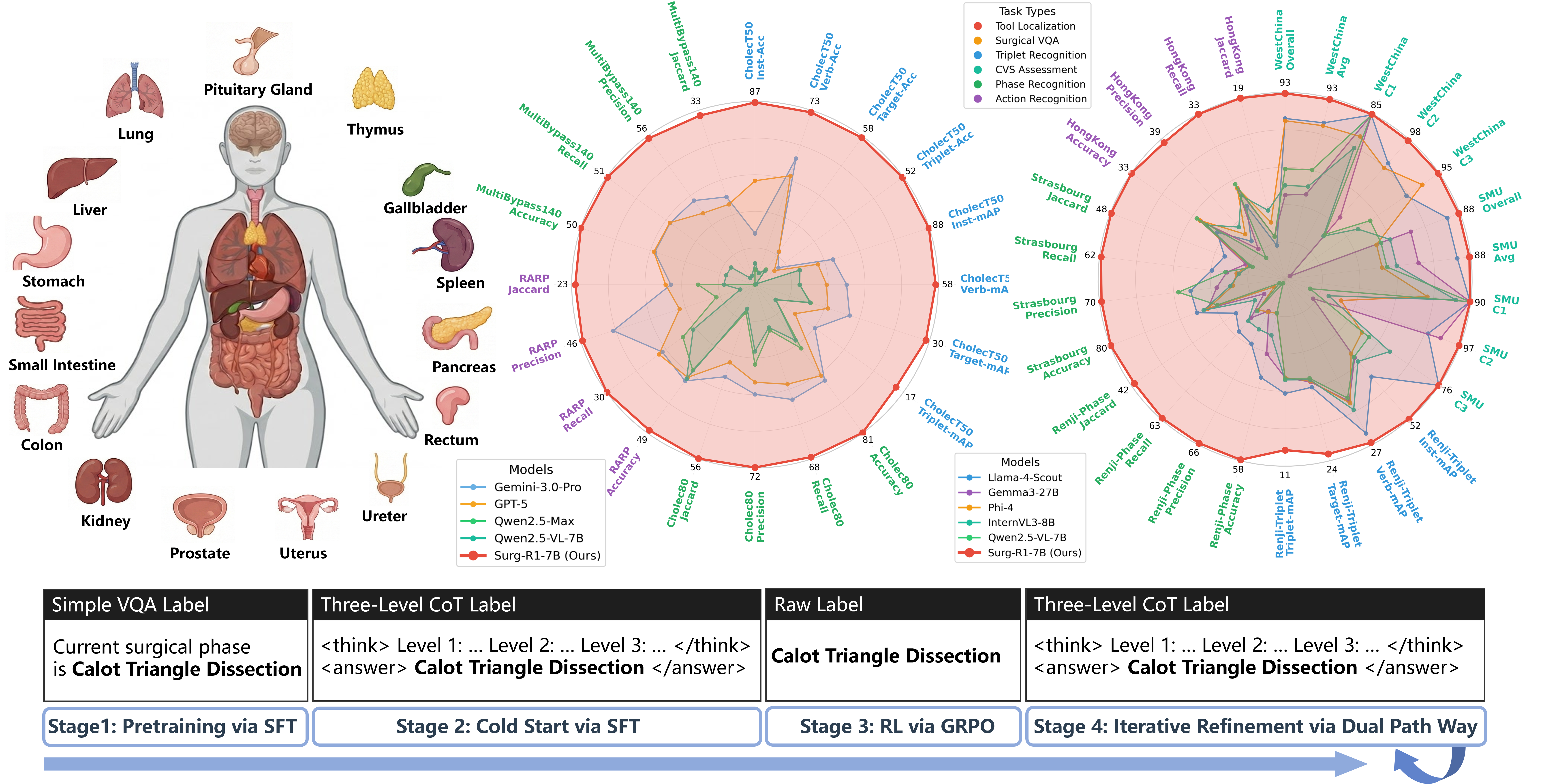 Surg-R1 overview: hierarchical reasoning, evaluation radar charts, and training pipeline