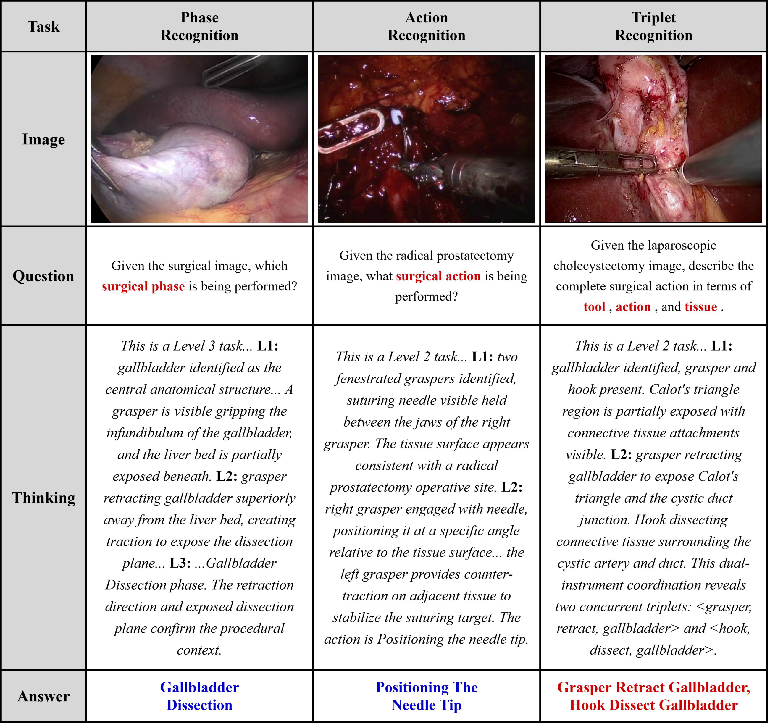 Qualitative results: instrument localization, phase recognition, action recognition, triplet recognition, and critical view of safety assessment